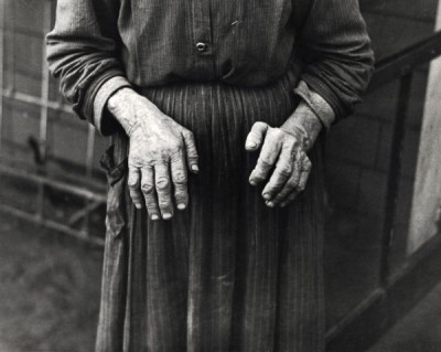 Russell Lee Collection: The Hands of Mrs. Ostermeyer, Wife of a Homesteader, Woodbury County, Iowa, 1936