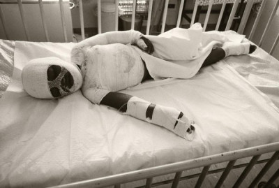 Life in the Liberated Zone: Public Medacine - Burns Unit Childrens War, late 1980s